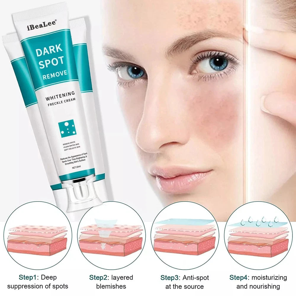 Whitening Freckle Cream Remove Dark Spots Anti-Freckle Cream Niacinamide Fade UK