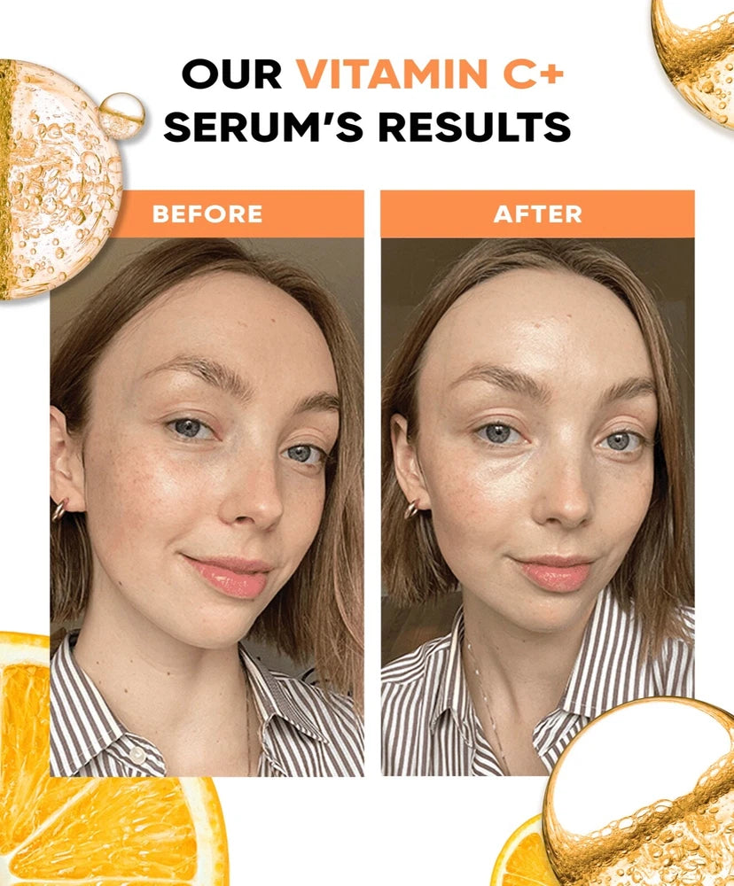 Vitamin C Serum for face 12% with Hyaluronic Acid Vitamin B5 & E Anti-Aging 30ml