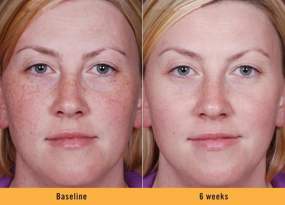 Intimate Skin Whitening Gel Lightening Body Bleach Cream, Vaginal/Anal Bleaching