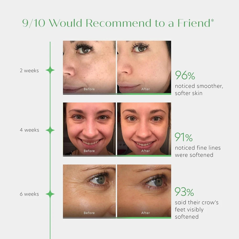 Retinol Face Lift Serum cream + Vitamin C  Hyaluronic Acid Anti Ageing Wrinkle