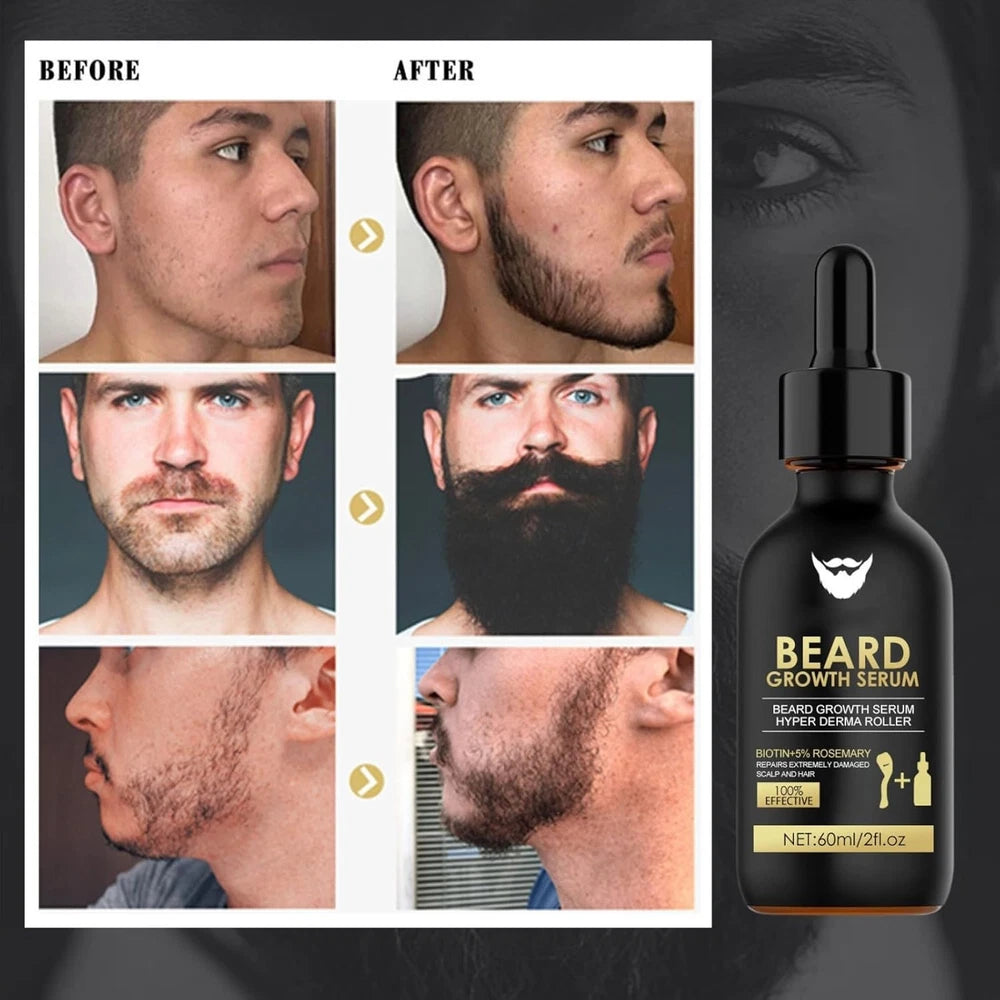 Beard Growth Oil Fast Growing Beard Mustache GROOMING Kit Derma Roller for Men