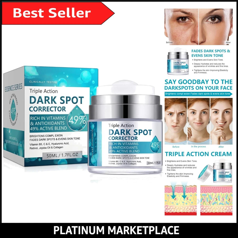 Hyperpigmentation Treatment Cream for Even Skin Tone - 50ml Dark Spot Remover