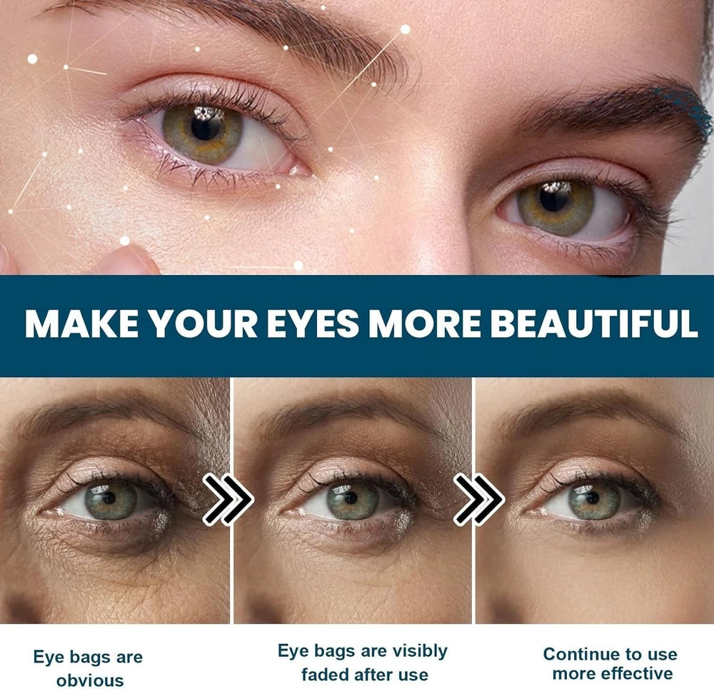 Anti Wrinkle Eye Bags Cream serum, Collagen Boost  Anti-Aging Eye Lift 1 or 2pcs