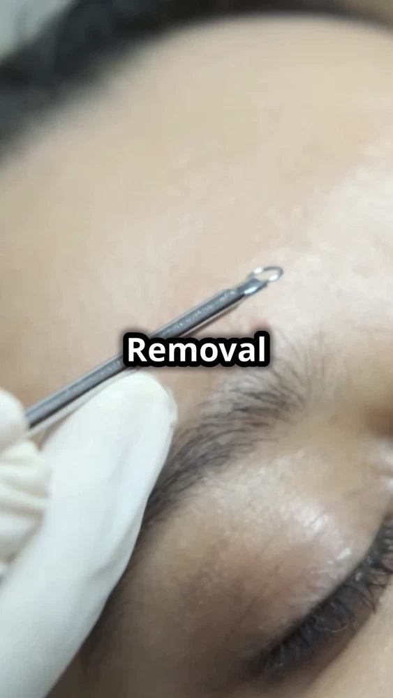 7x Blackhead Remover Tools Pimple Comedone Spot Acne Extractor Kit Popper