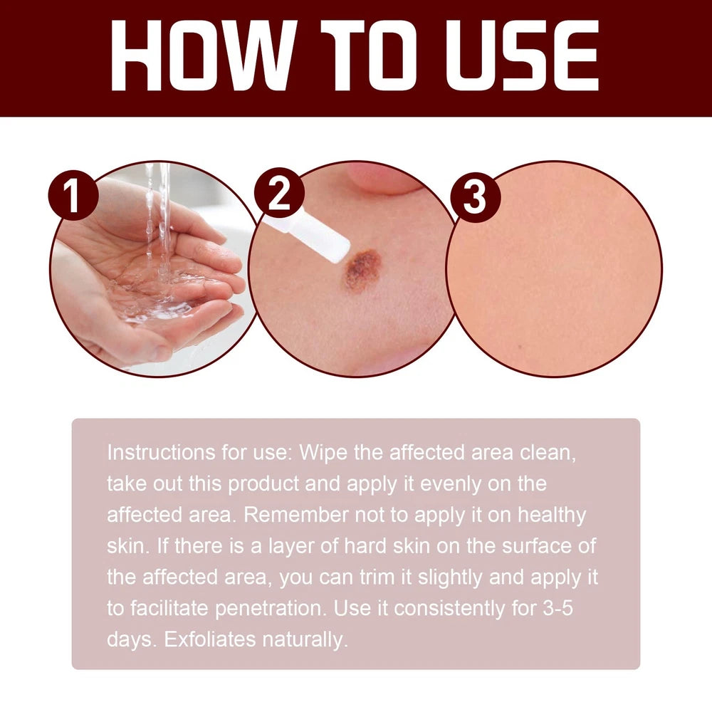 2PC 12 Hours Wart Remover Pen Skin Tag Mole Remover Eliminate Foot Corn Warts