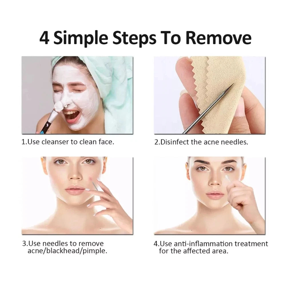 4x Blackhead Remover Tool Kit Spot Acne Pimple Comedone Extractor Popper Comedon