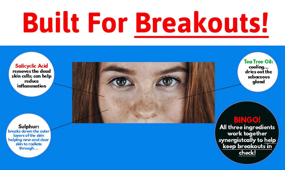 Vteen Salicylic Acid Spot Treatment Cream for Blackheads Milia Blemishes 50grams