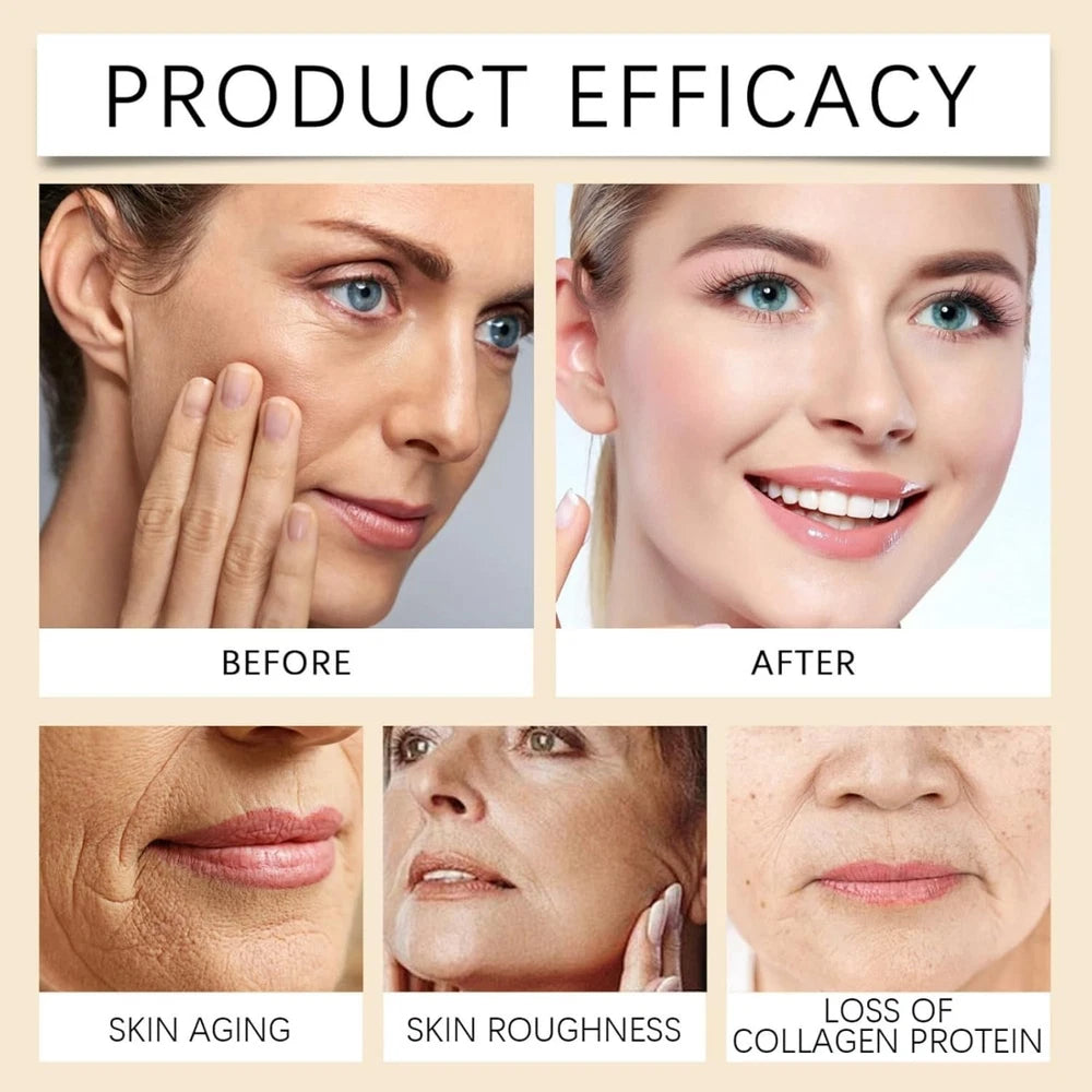 Bee Venom Wrinkle Removal Cream,Bee Venom Face Serum,Skin Firming Cream,Bee Veno