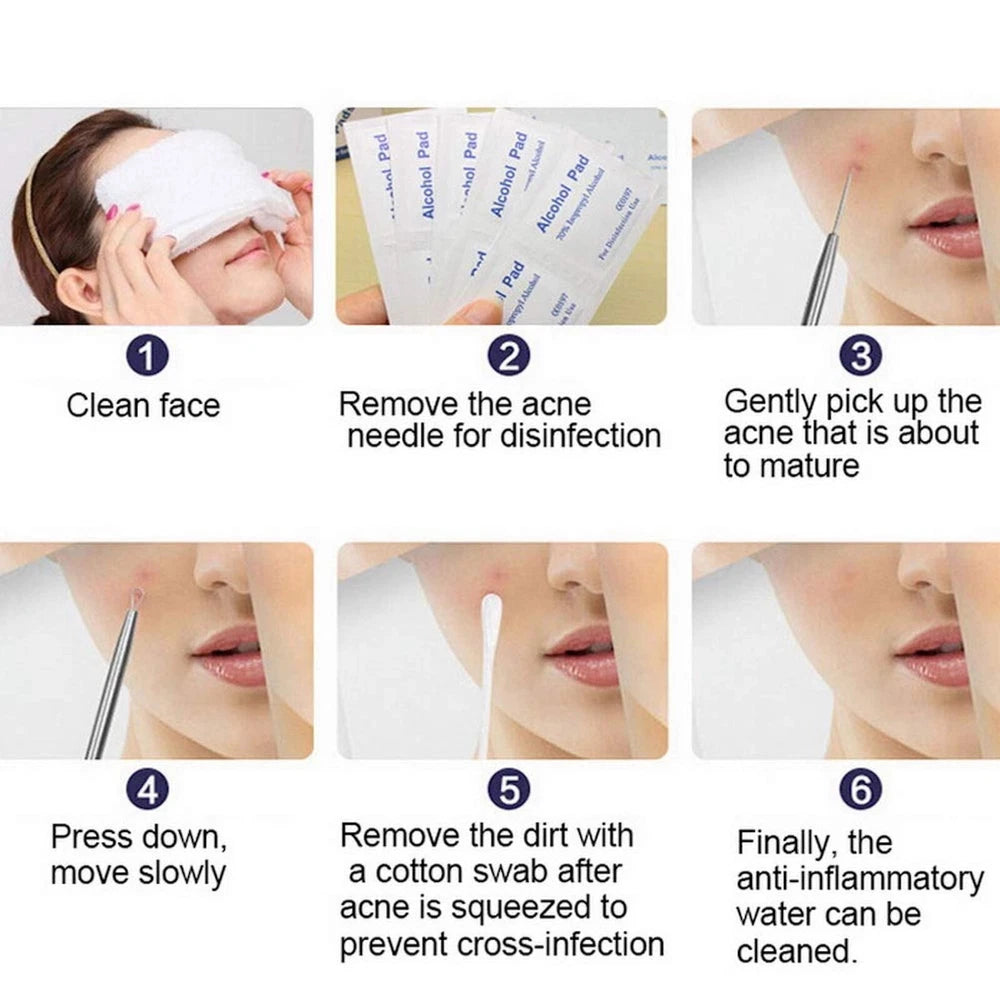 7x Blackhead Remover Tools Pimple Comedone Spot Acne Extractor Kit Popper