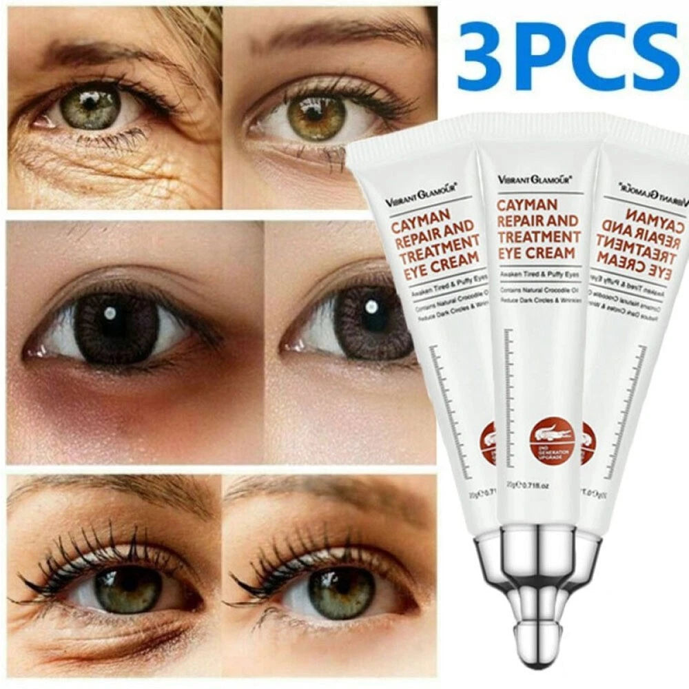 3~Magic Eye Cream for Dark Circles and Puffy Eyes| Under Eye Cream for Women/Men