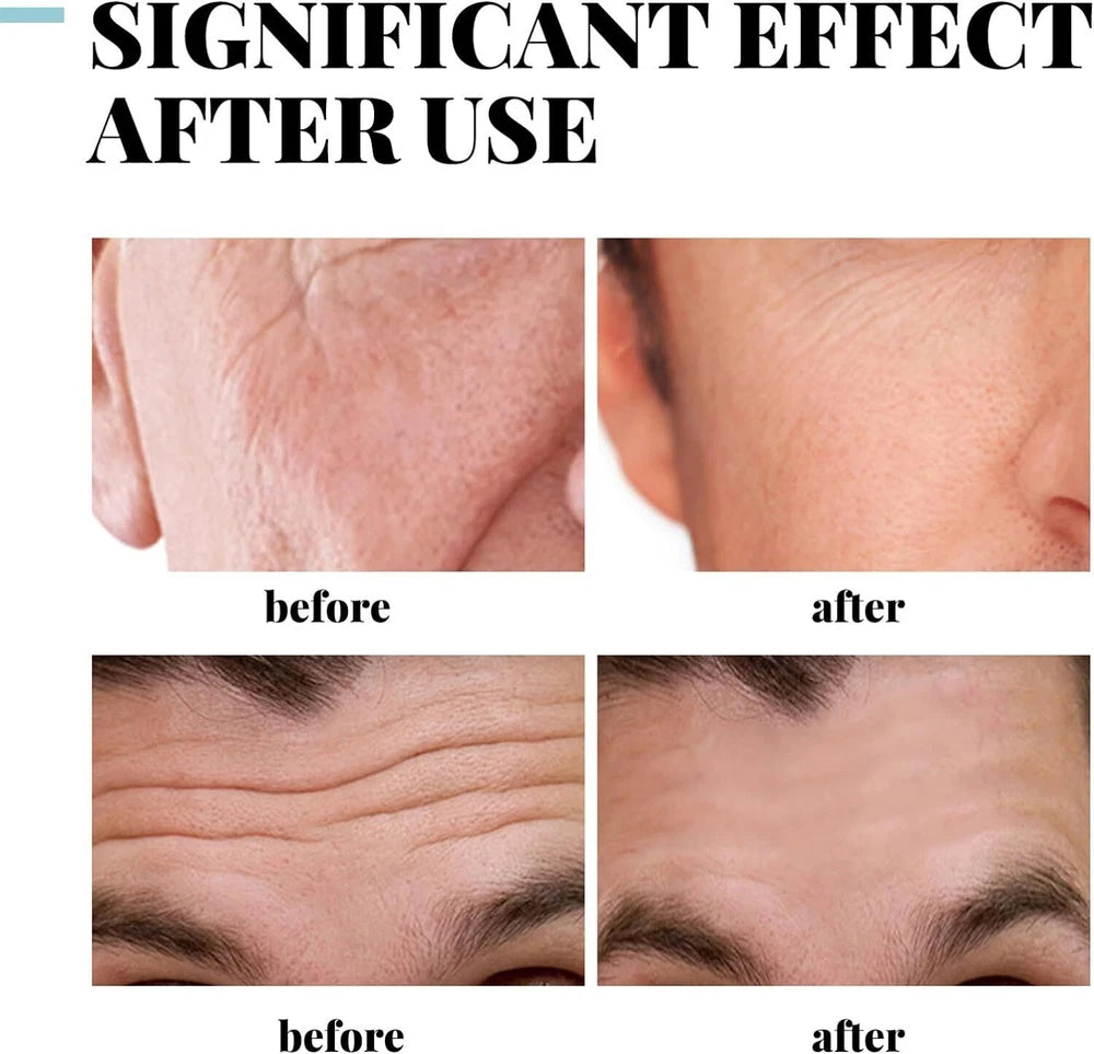 Collagen Face Lift Cream Anti Ageing Wrinkles Hyaluronic Acid Face Moisturiser