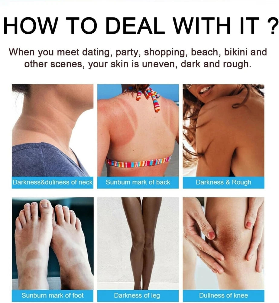 Skin Whitening Lightening Cream Bleaching Moisturiser For Face Body - 50g
