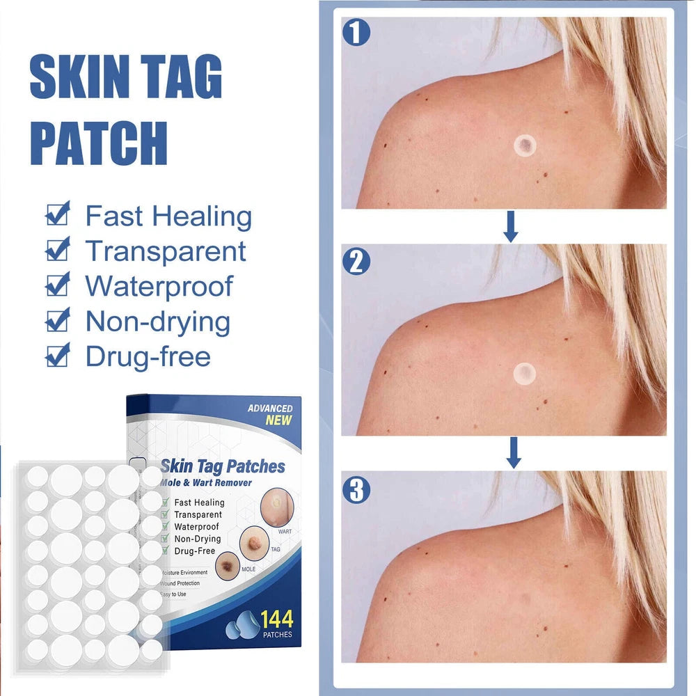144pcs Skin Tag Remover Patches Quick Effective Mole Wart Removal Pad Sticker UK