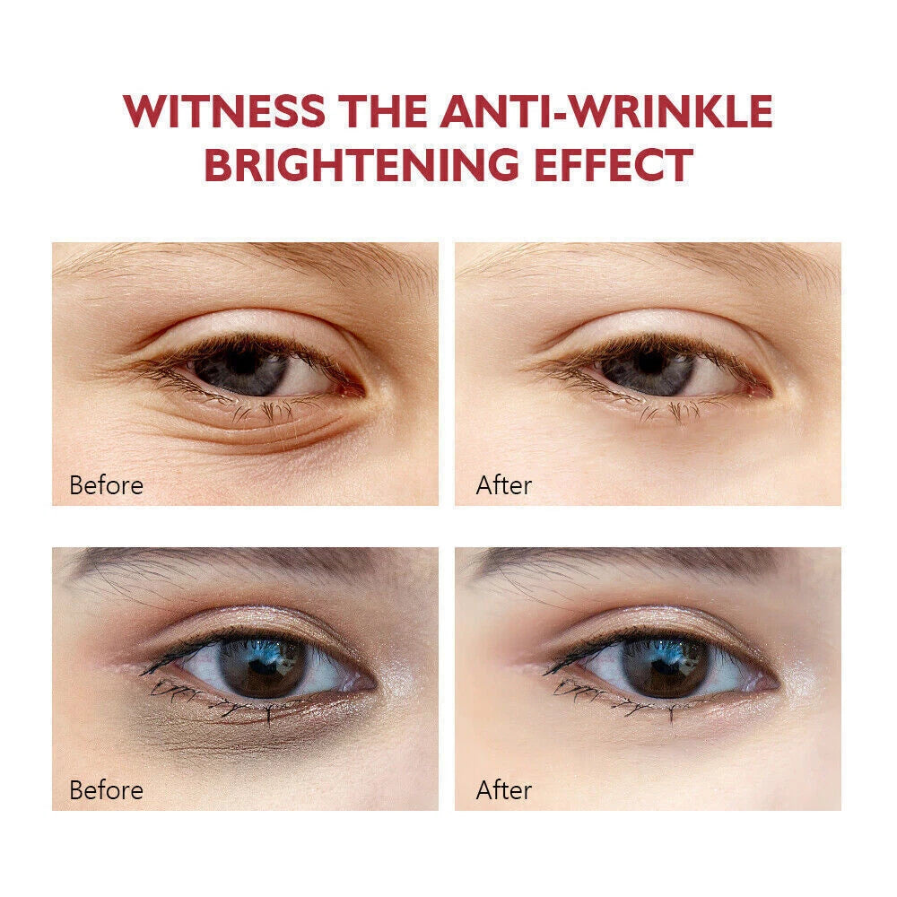 Best 100% Under Eye Cream Retinol, Remove Dark Circles Wrinkles Lines Puffy Eyes