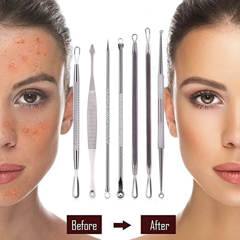 7x Blackhead Remover Tools Pimple Comedone Spot Acne Extractor Kit Popper