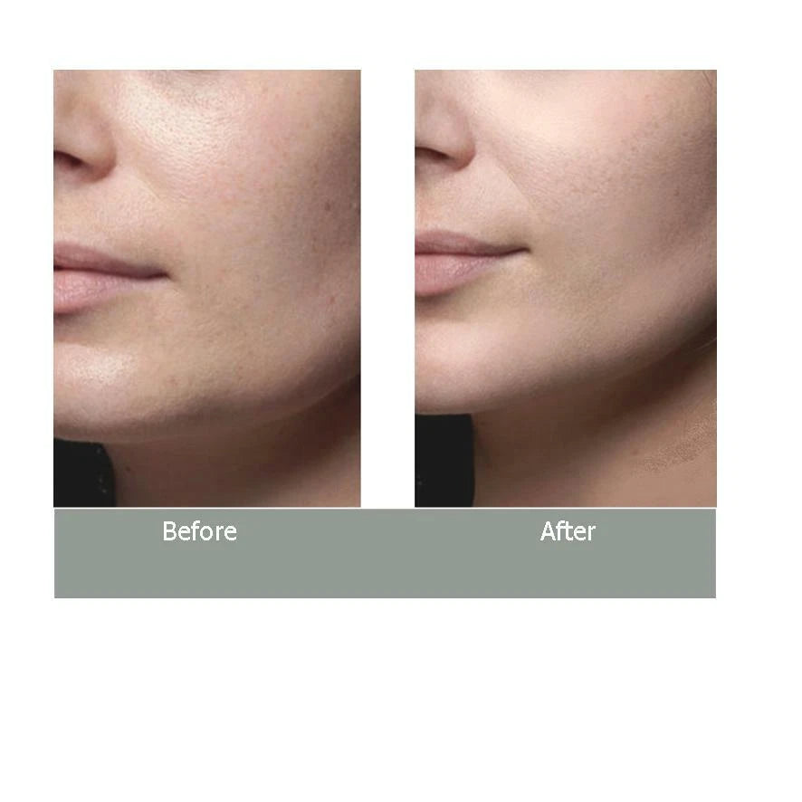 INSTANT FACE LIFT ANTI WRINKLE CREAM FINE LINE SERUM WORKS INSTANTLY ⭐️⭐️⭐️⭐️⭐️