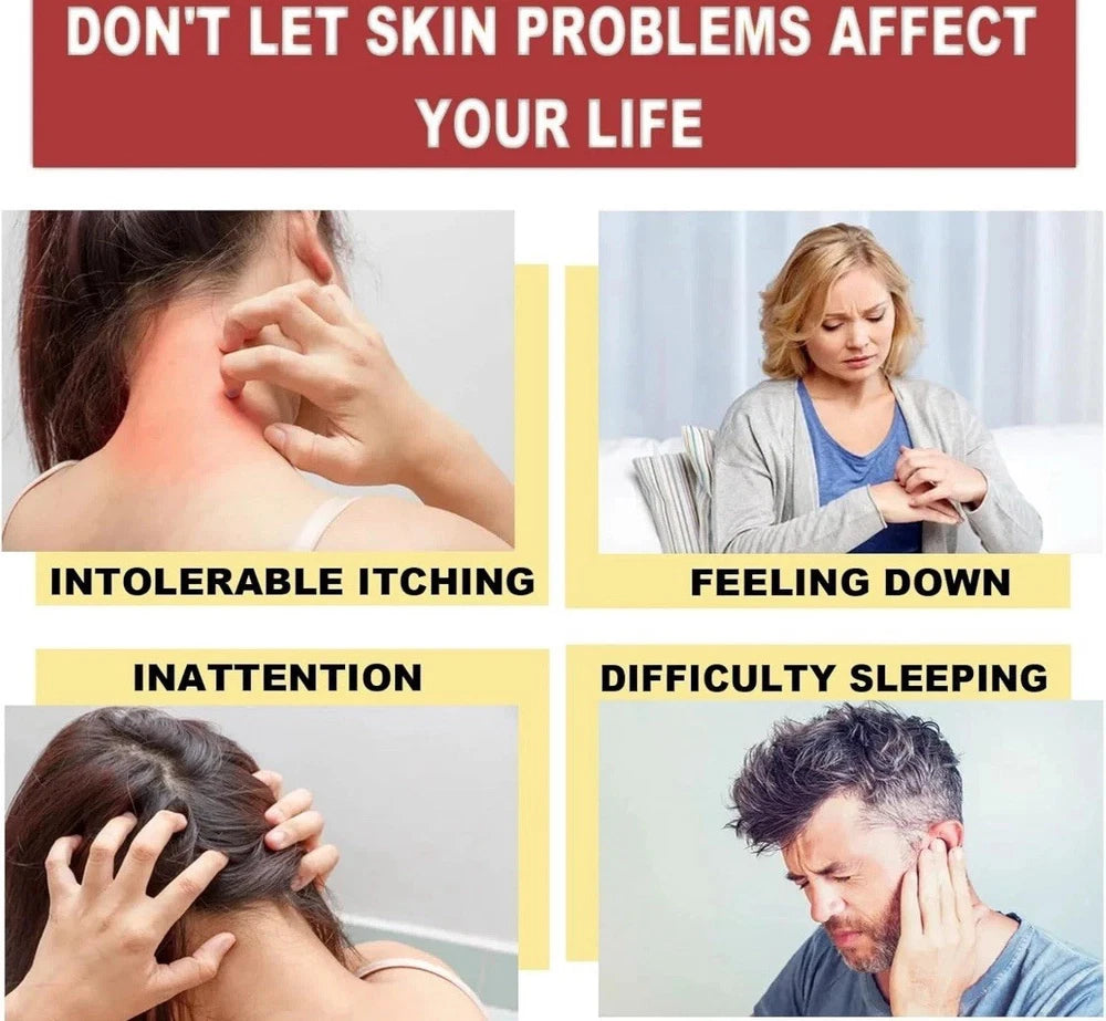 3pcs Antifungal Cream,Cream for Itchy Skin,Antifungal Cream for Skin,Itchy Skin