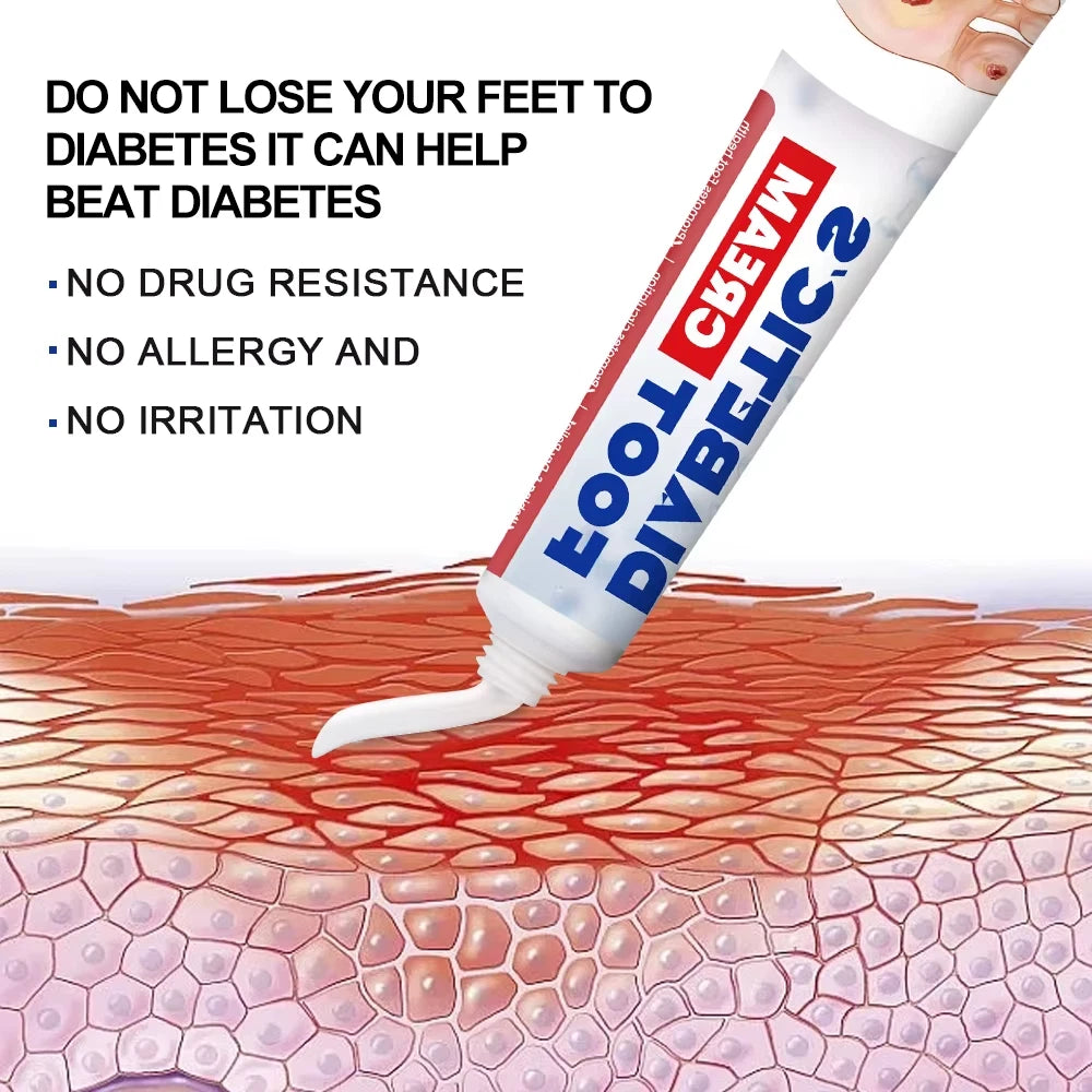 20g New Diabetic Foot Cream Ulceration Feet Erosions Anti Itchy Skin Repair