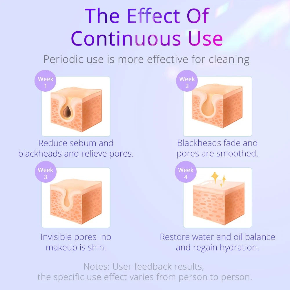 6 in1 Hydra Spa Water Facial Cleaner Aqua Peel Hydro Dermabrasion Beauty Machine