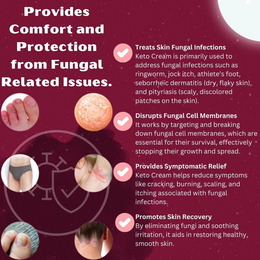Antifungal Cream Relief from Jock Itch, Athletes Foot, Psoriasis, Ringworm, Acne