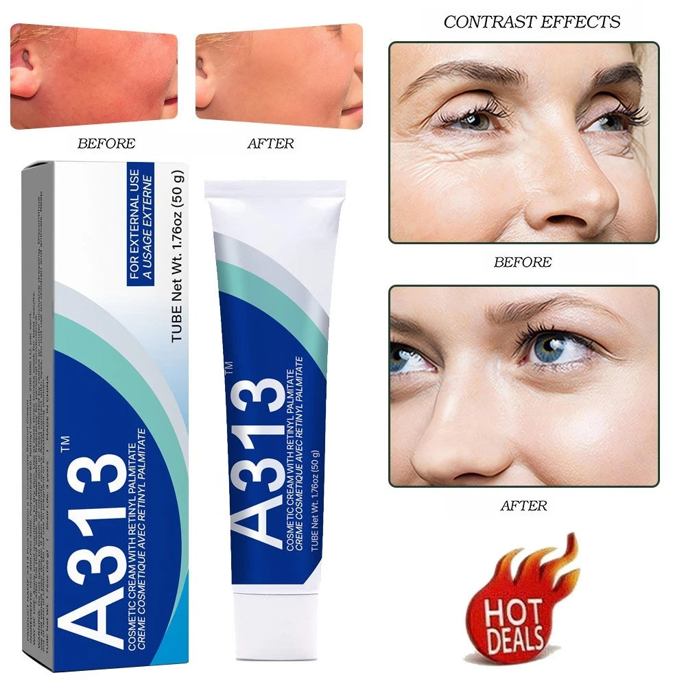A313 Cosmetic Retinol Cream – 50g – Sealed Box