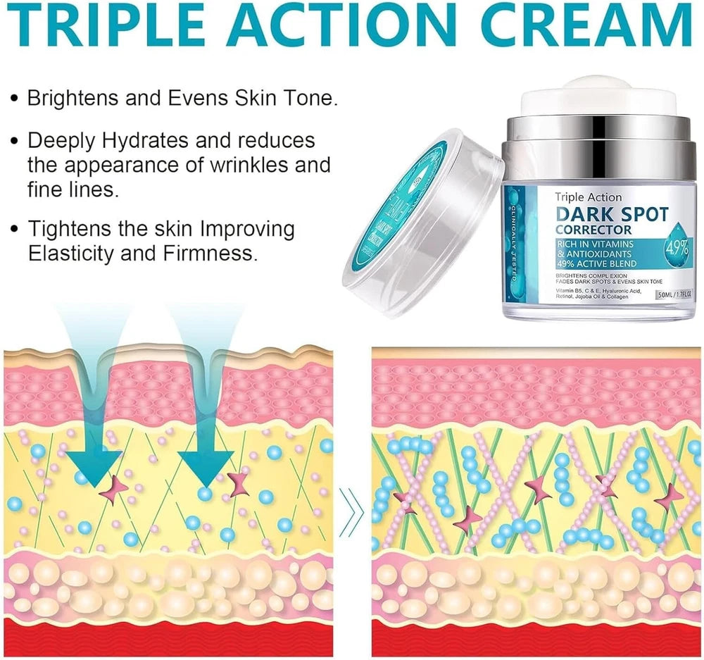 Hyperpigmentation Treatment Cream for Even Skin Tone - 50ml Dark Spot Remover