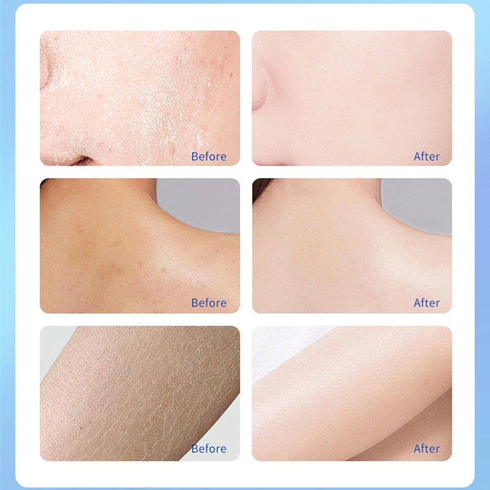 A313 Cosmetic Retinol Cream – 50g – Sealed Box