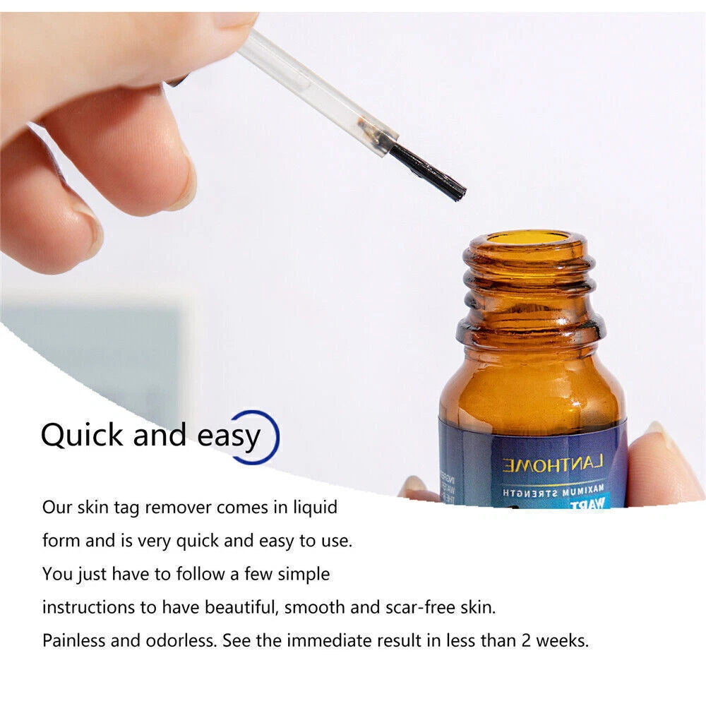 Wart Remover Liquid Skin Tag Mole Remover Eliminate Feet Corn Wart Removal〃