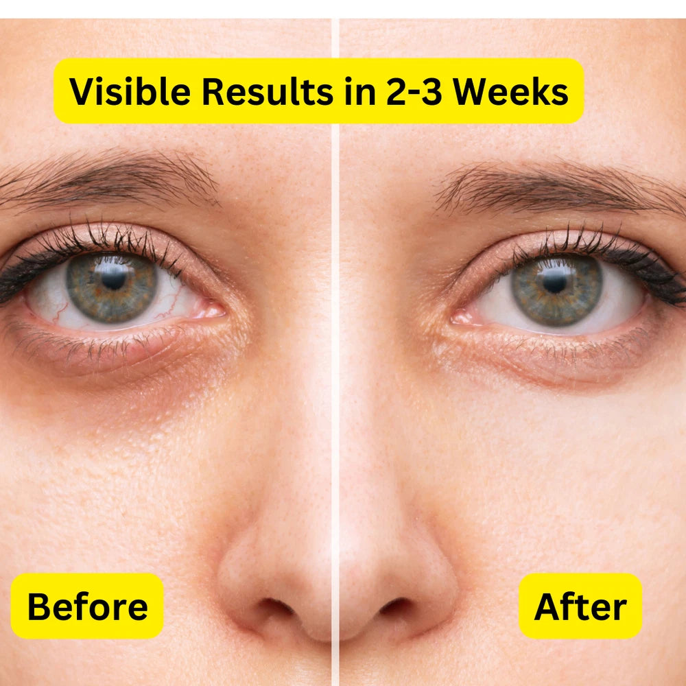 Eye Cream for Dark Circles and Puffy Eyes| Under Eye Cream for Women/Men.