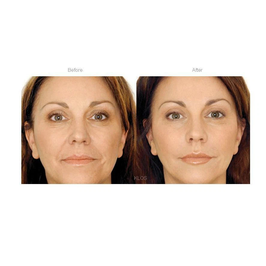 INSTANT FACE LIFT ANTI WRINKLE CREAM FINE LINE SERUM WORKS INSTANTLY ⭐️⭐️⭐️⭐️⭐️