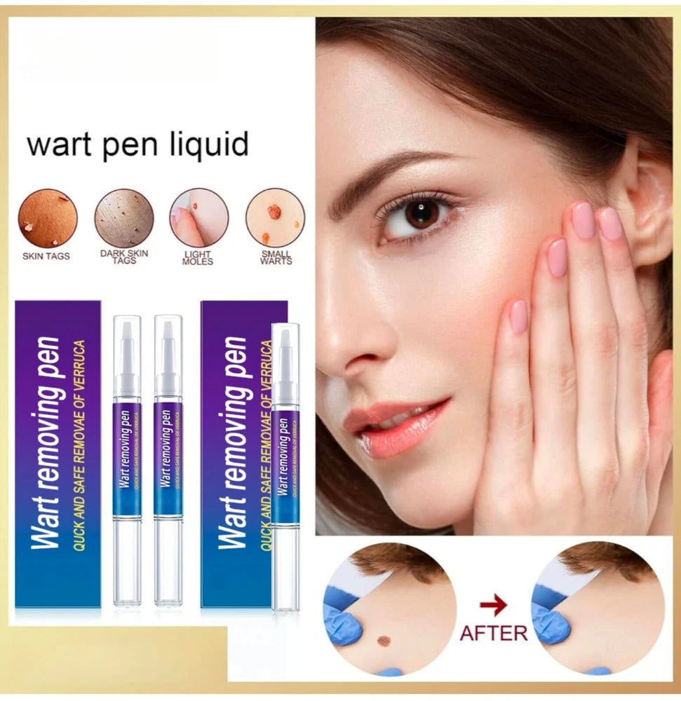 12 Hours Wart Remover Pen Skin Tag Mole Quick Remover Eliminate Foot Corn Warts