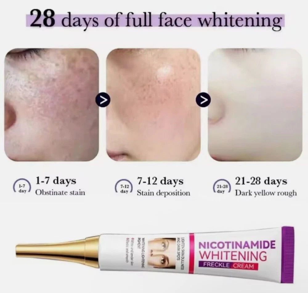 2pcs Dark Spot Niacinamide Lighting Melasma Cream Effectively Freckles Remover