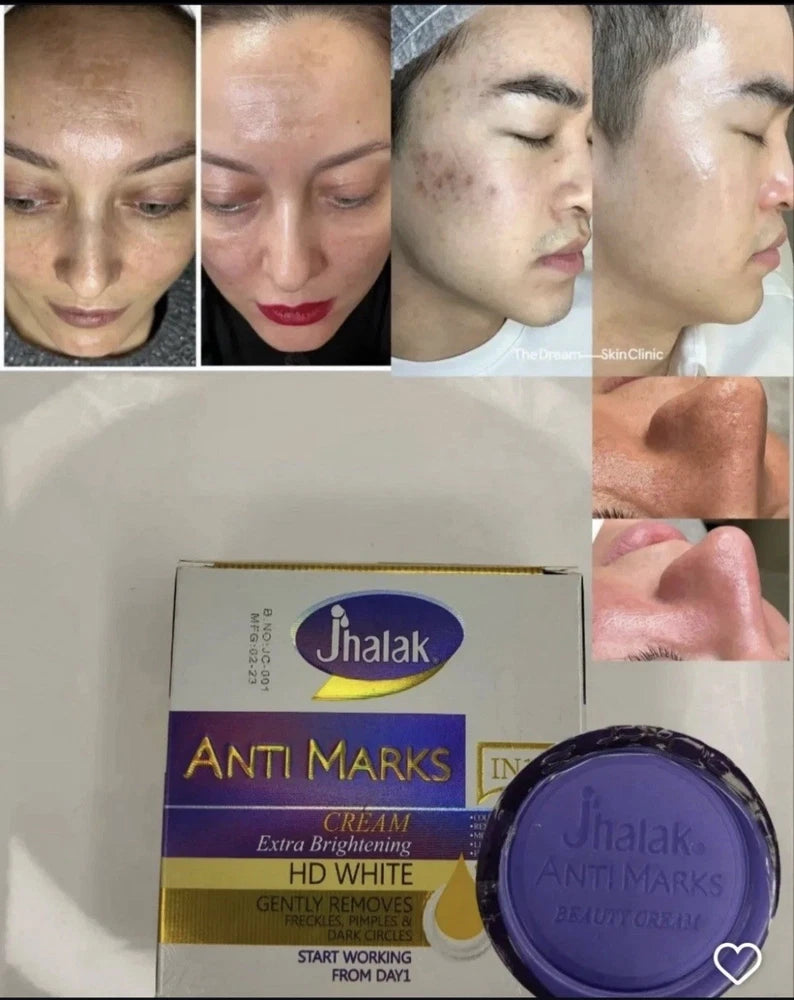 Jhalak Anti Marks Extra Brightening HD White Face Cream 30g (Result from day 1)