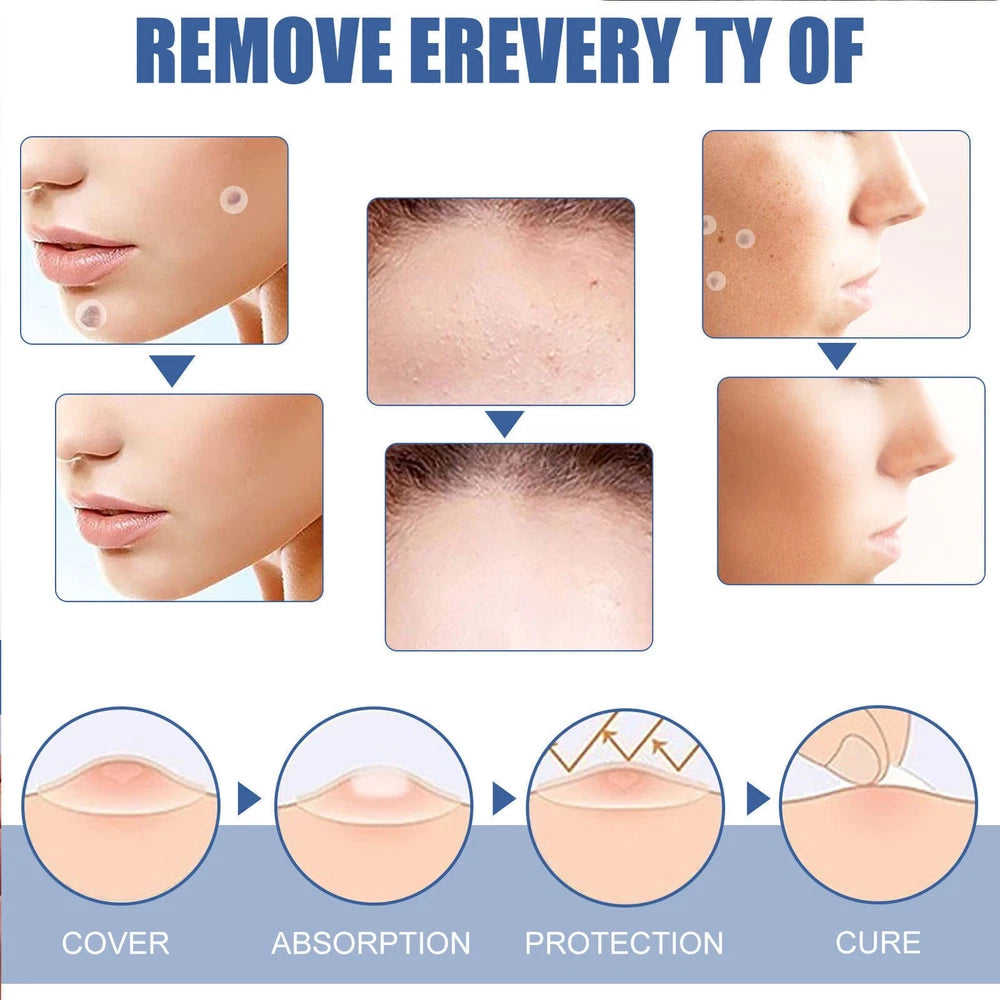 144pcs Skin Tag Remover Patches Quick Effective Mole Wart Removal Pad Sticker UK