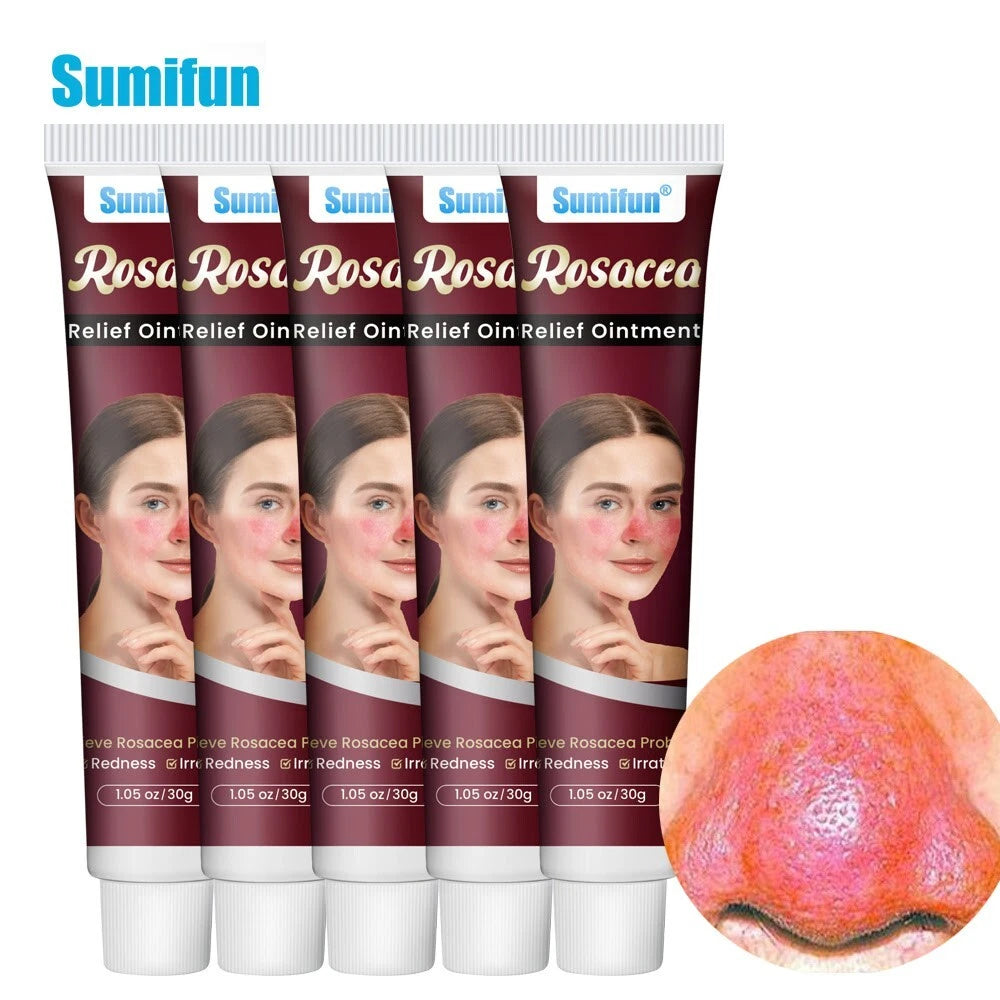 New 30g Natural Herbal Red Face Skin Care Rosacca Cream Red Skin Relief Ointment