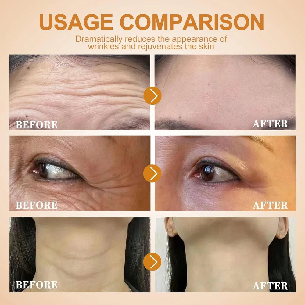 2PCS Bee Venom Cream,Bee Venom Wrinkle Removal Cream,Anti Wrinkle Firming Multi