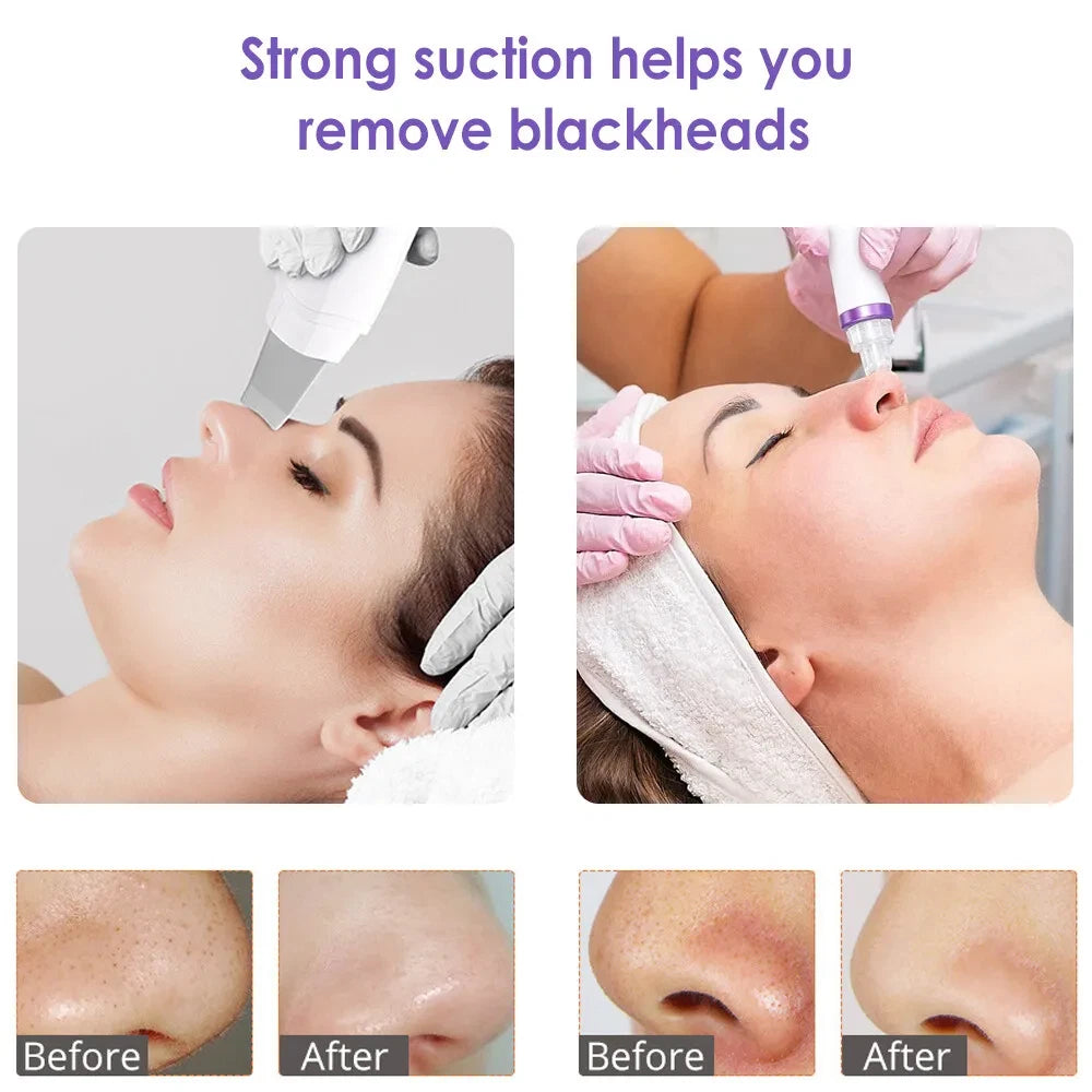 6 in1 Hydra Spa Water Facial Cleaner Aqua Peel Hydro Dermabrasion Beauty Machine