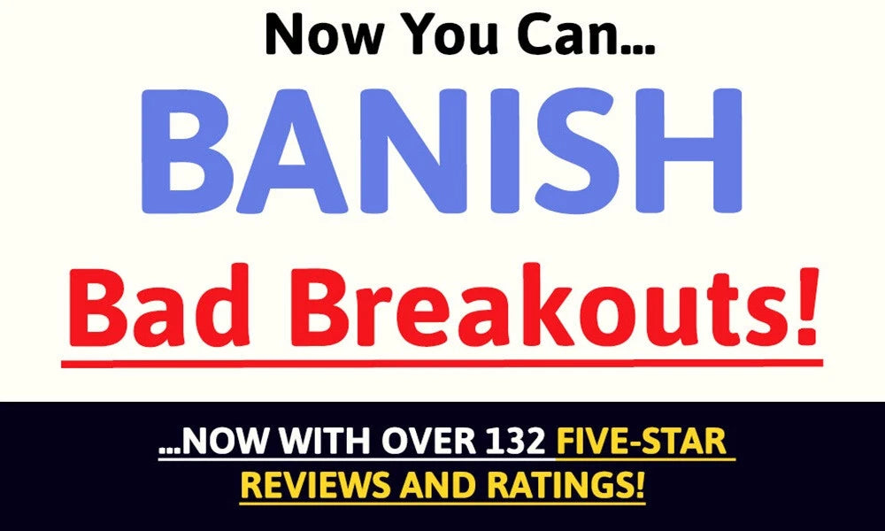 V88 MAX DOUBLE STRENGTH Spots Problem Skin Blackheads Blemishes Breakout Cream