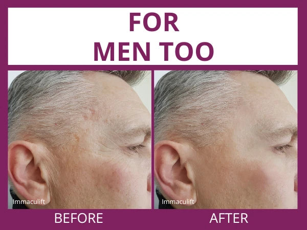 INSTANT WRINKLE Eye Tightener Cream Wrinkle Remover Serum with Argireline