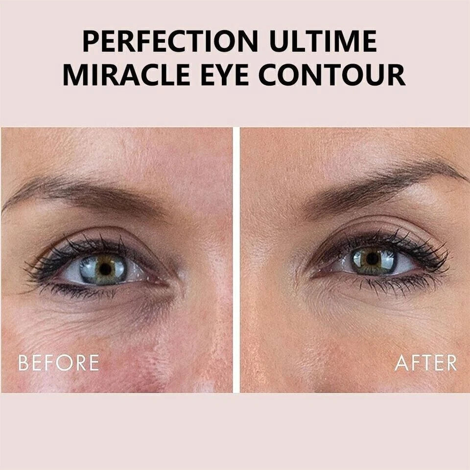 Anti Aging  Eye Cream for Dark Circles & Wrinkles – Anti-Aging, Puffiness Relief