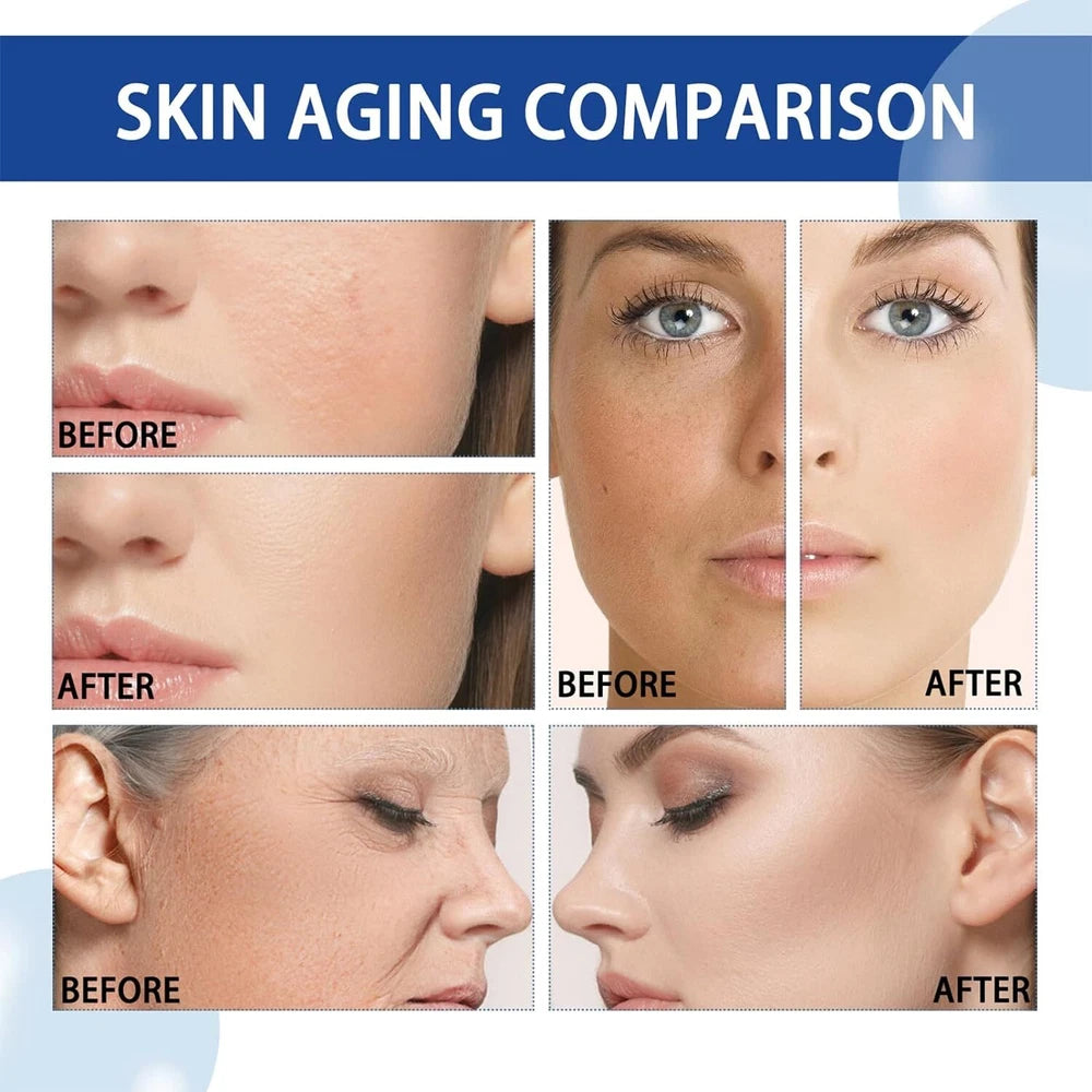 Anti Ageing Serum Wrinkles Skin Plumping Rejuvenating Collagen - Hyaluronic Acid