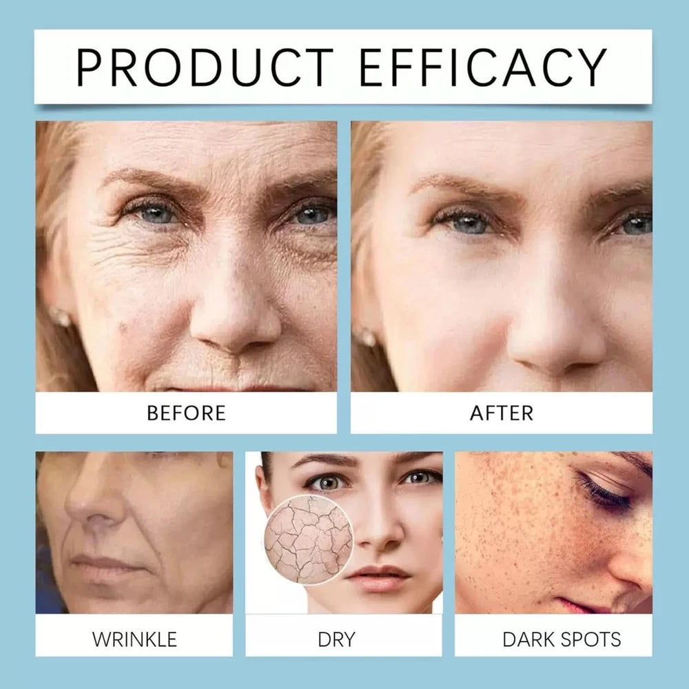 Anti Wrinkle Liquid Solution Serum Face Lift Skin Plumping Firming & Dark Spots