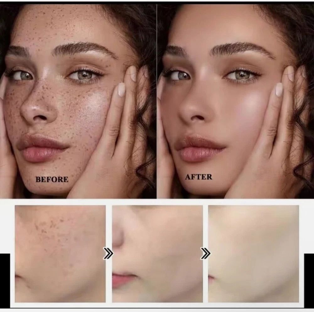 2pcs Dark Spot Niacinamide Lighting Melasma Cream Effectively Freckles Remover