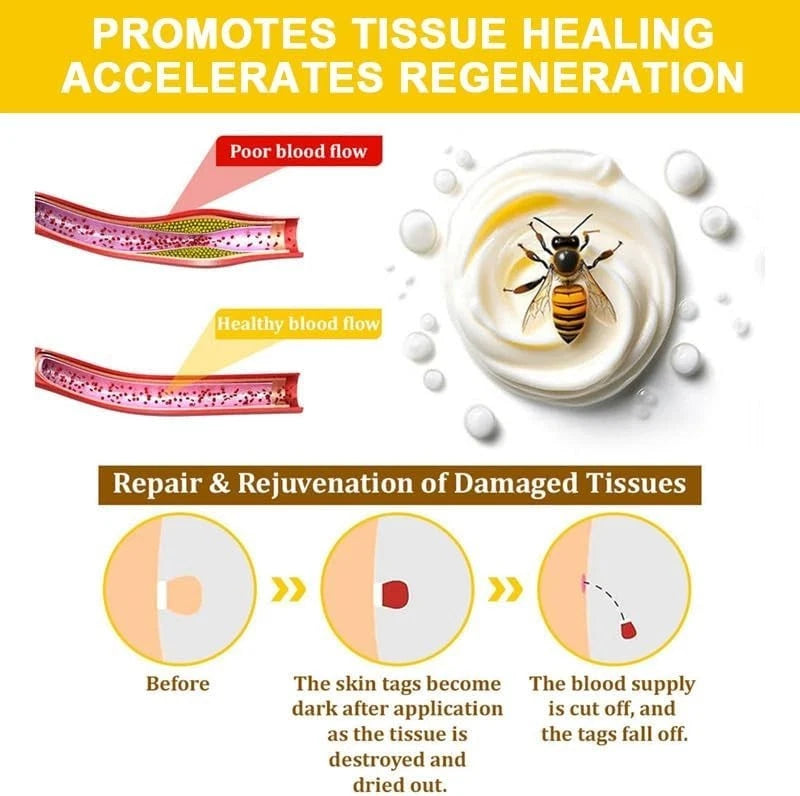 2Pcs Bee Venom Skin Treatment Cream, Bee Venom Cream, Skin Repair, Enric