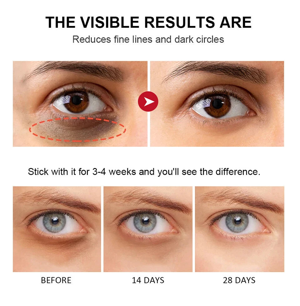 Retinol Anti Ageing Under Eye Bags Dark Circles Wrinkle Reducer Stick Face Lift