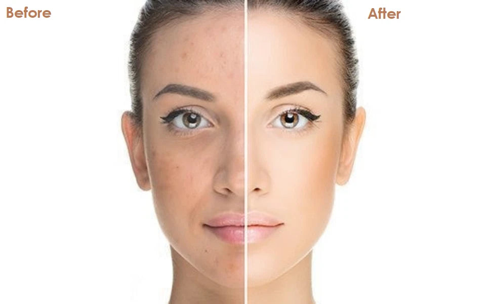 Extreme Whitening Face Cream Dark Spots Blemishes Bikini Under Arms Full Body