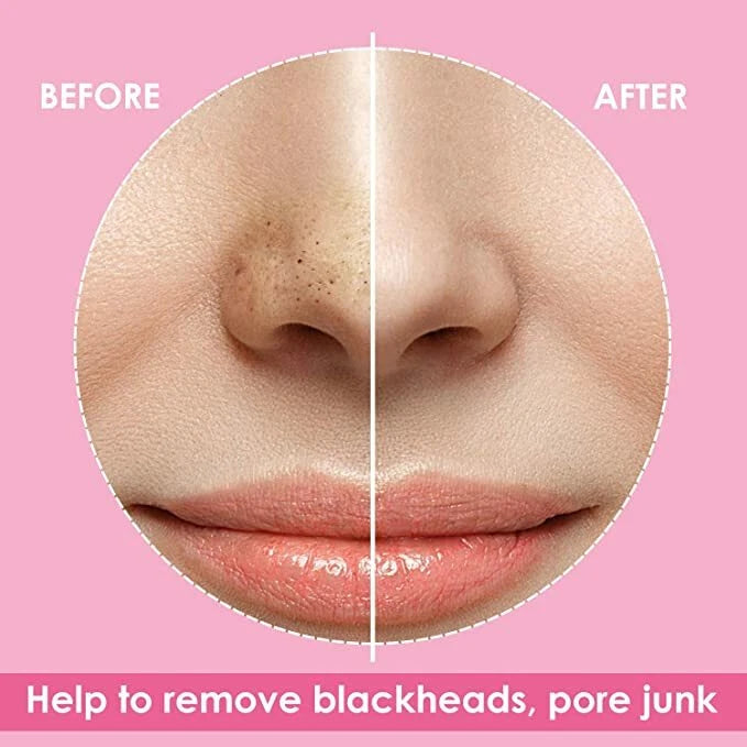 10 or 5 Pcs Blackhead Spot Removal Nose Face Pore strips Deep Cleansing Unclog
