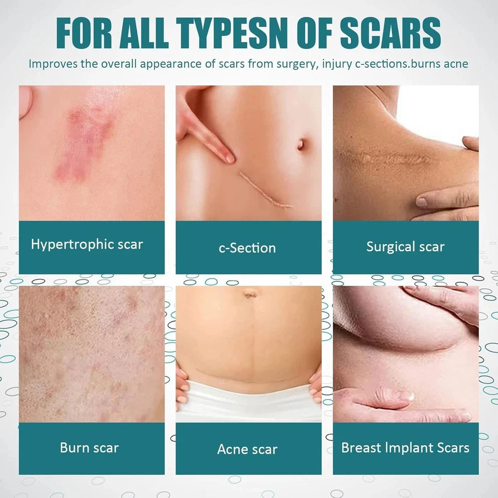 Scar Removal Cream Silicone Gel for Old & New Scars Surgery Stretch Marks