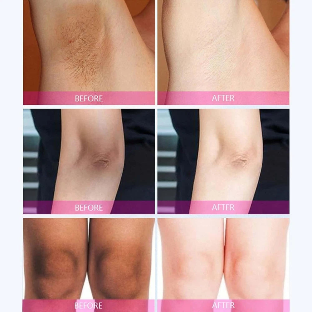 Kojic Acid Skin Cream - Korean Whitening Care & Underarm Cream for Intimate Area