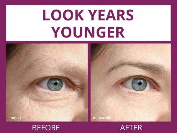 INSTANT WRINKLE Eye Tightener Cream Wrinkle Remover Serum with Argireline